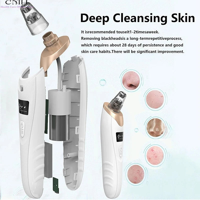CMH Pore Cleansing Blackhead Vacuum & Skin Tool
