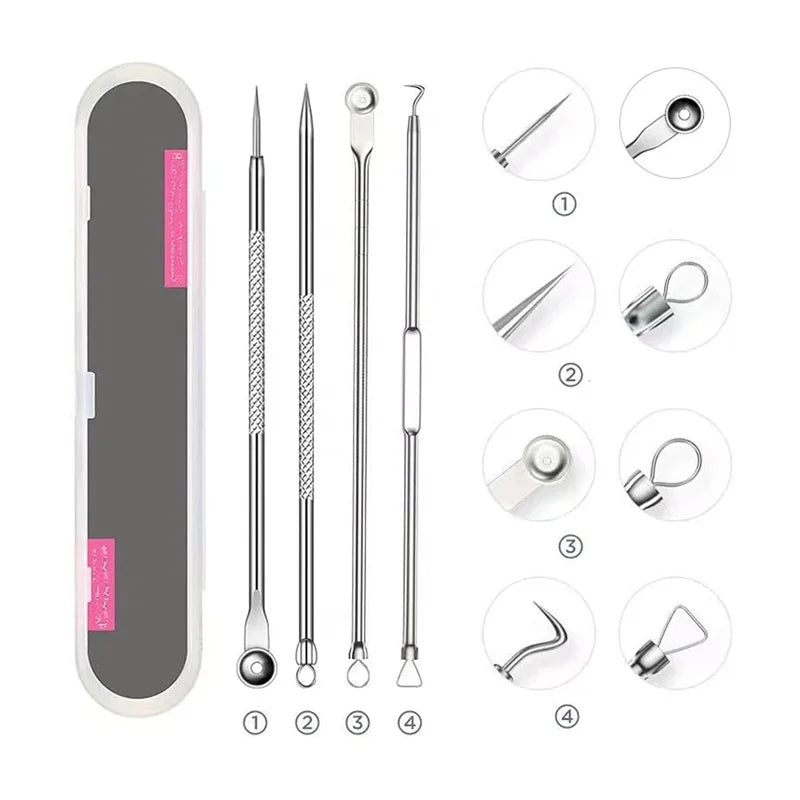 5-in-1 Blackhead Extractor: Squeeze Acne Needles for Nose & Face